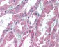 Endostatin Antibody (C-Terminus)